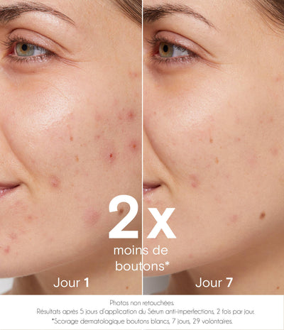 Sérum purifiant anti-imperfections