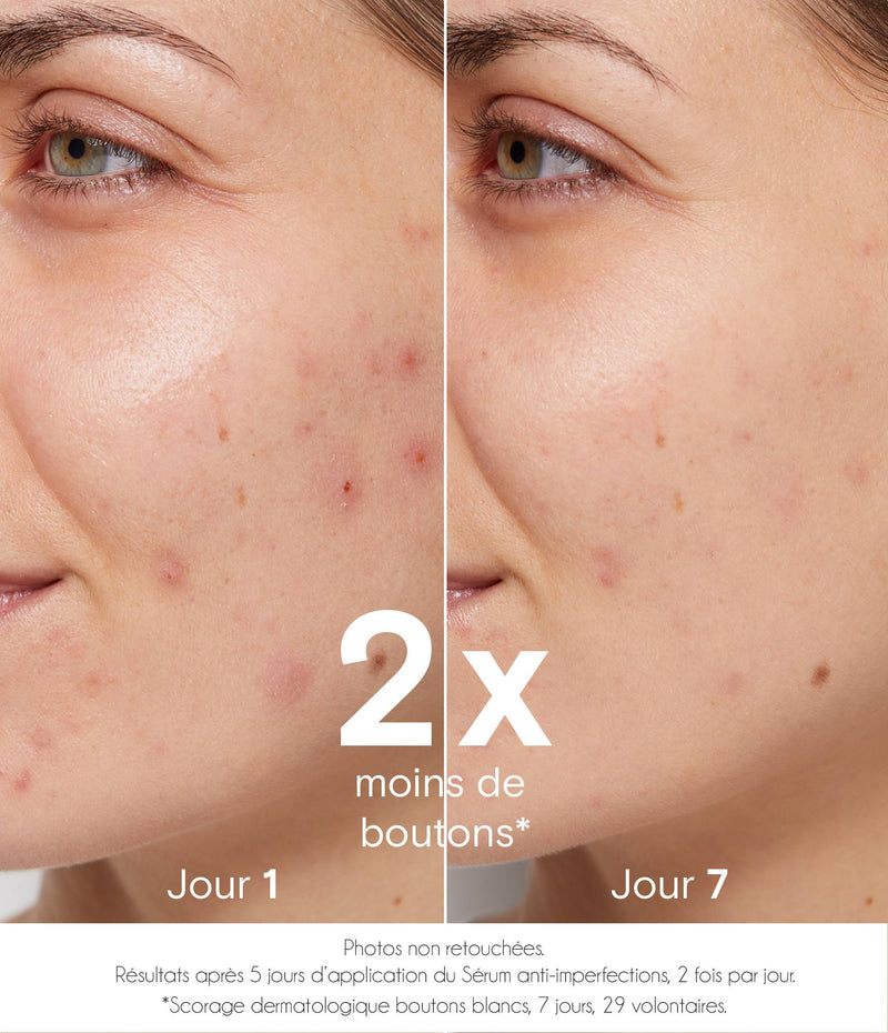 Sérum purifiant anti-imperfections