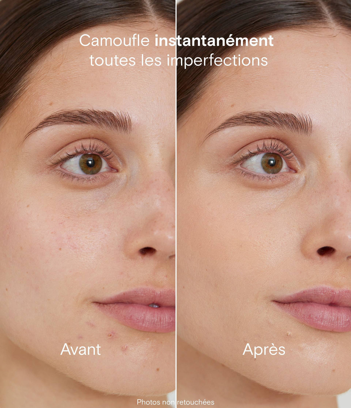 Routine anti-imperfections