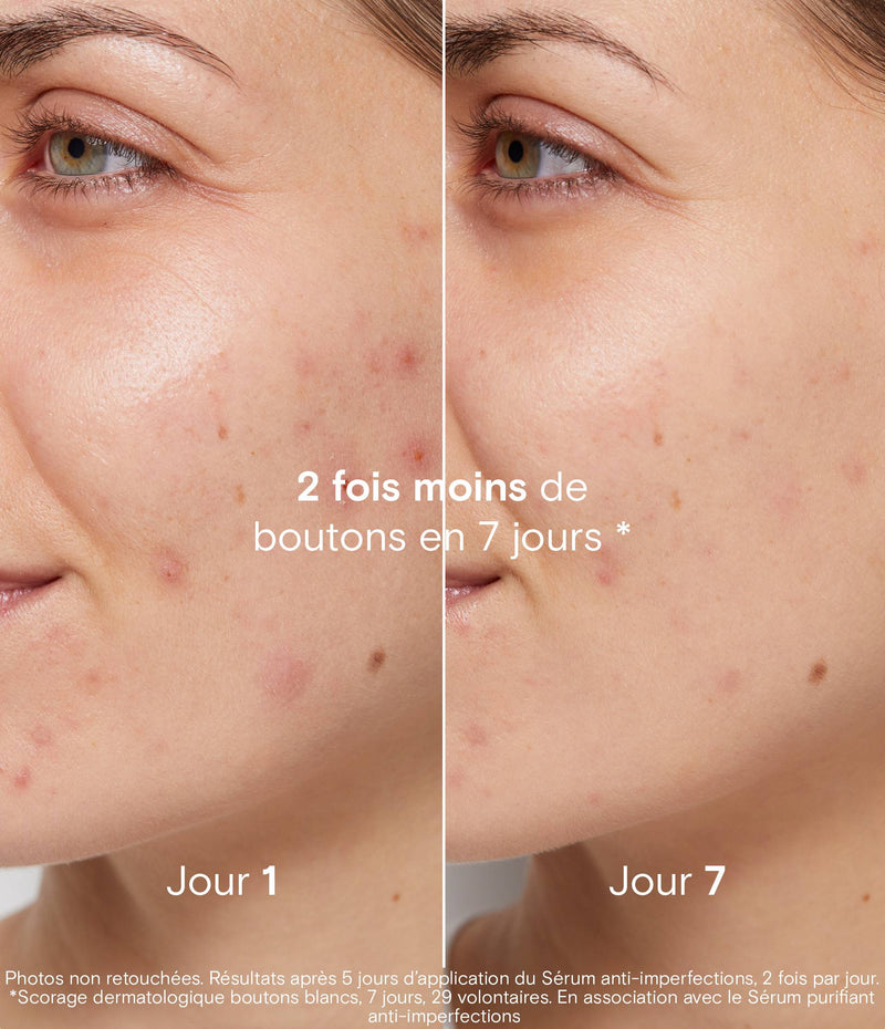 Coffret anti-imperfections