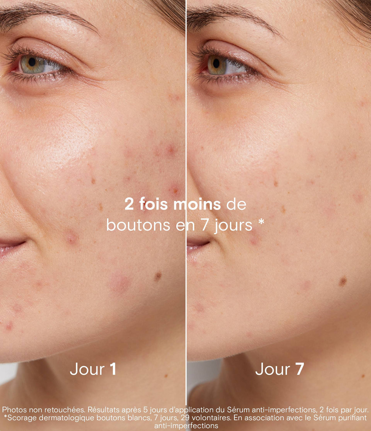 Recharge gel nettoyant anti-imperfections