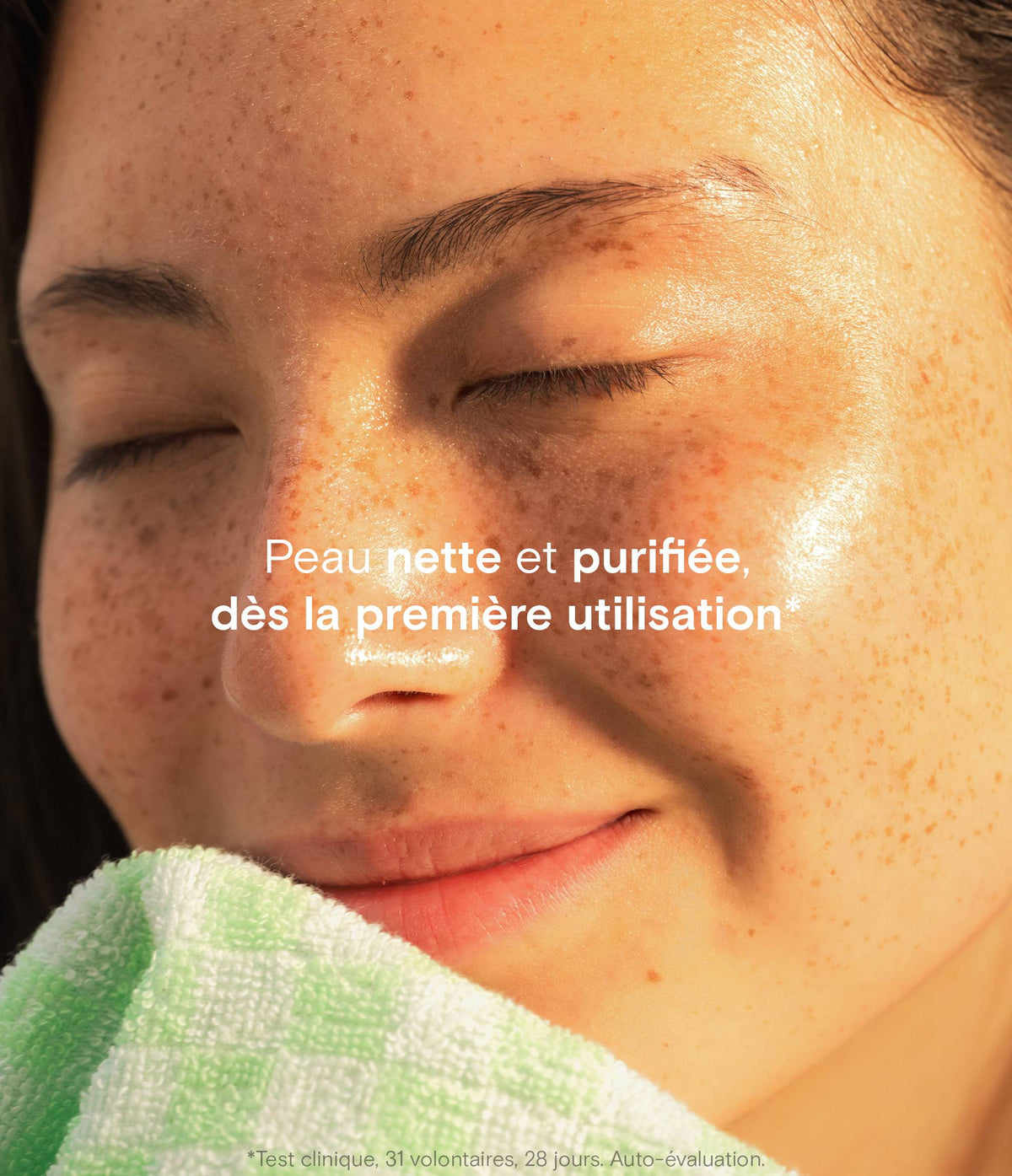 Coffret anti-imperfections